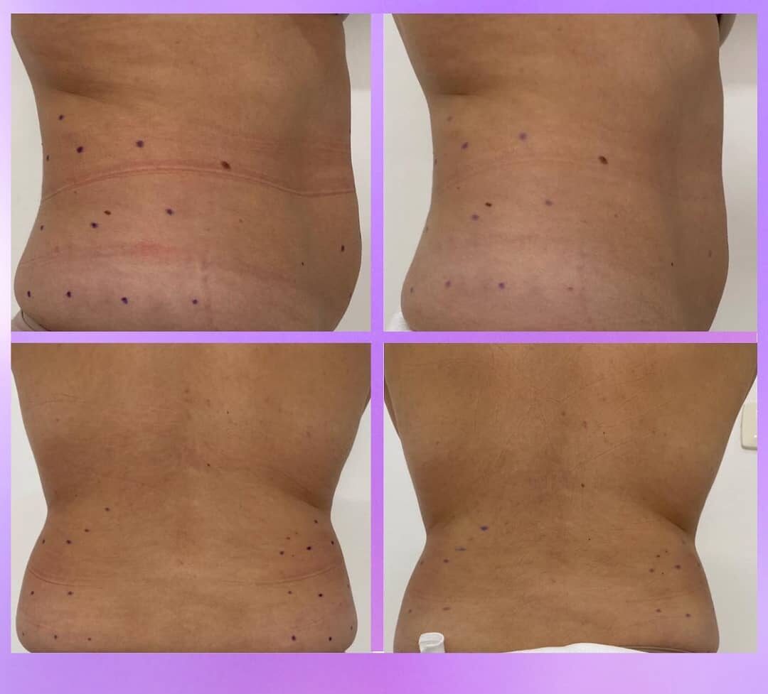 Massagem Modeladora em Santo André SP | Greicy França Estética