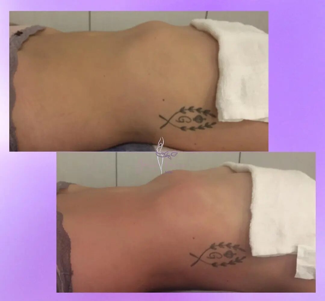 Drenagem Linfática em Santo André SP | Greicy França Estética