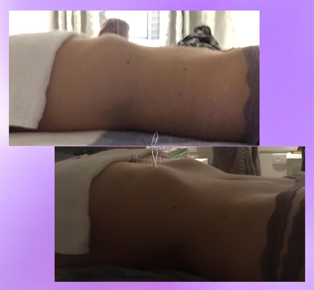 Drenagem Linfática em Santo André SP | Greicy França Estética