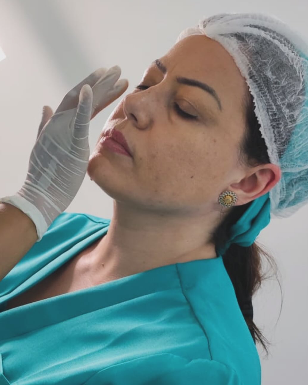 Peeling Facial em Santo André‑SP | Greicy França Estética