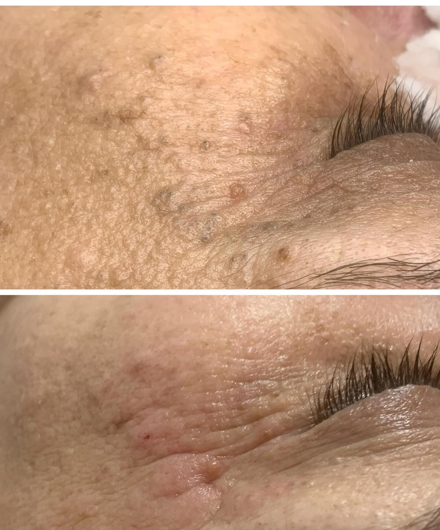 Limpeza de Pele em Santo André‑SP | Greicy França Estética